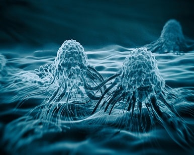 Pre-detection Reduces Fatal Risk of Cancer