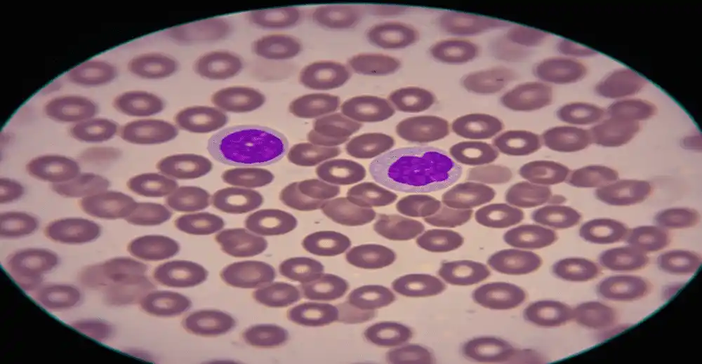 Haematology Diagnostics Market size worth US$2.777 billion by 2030